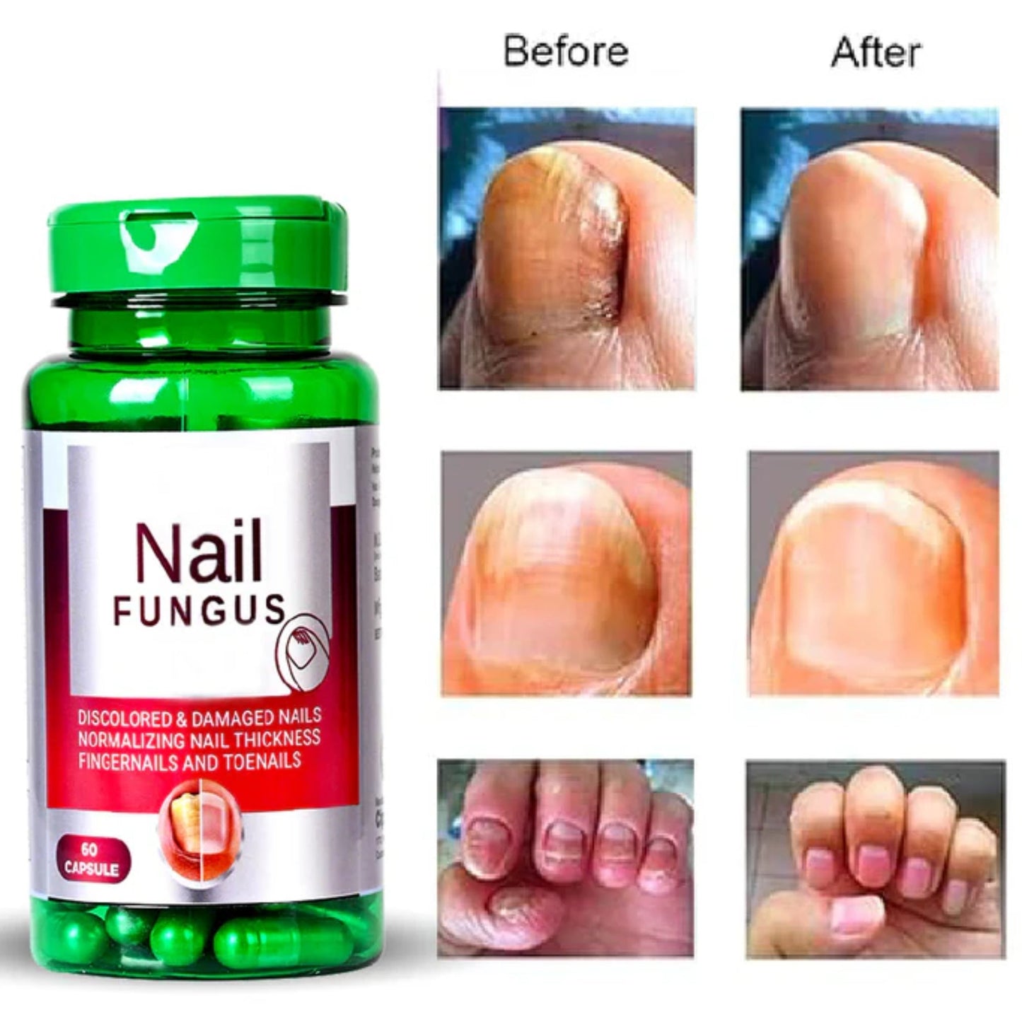 Cipzer Nail Fungus 60 Capsules | Herbal Remedy For Nail Infection, Itching, Cracks & Strong Nails