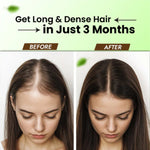 Cipzer Raughan-e-Aamla 200ML | Herbal Hair Oil for Growth, Dandruff, Hair Fall, Grey Hair & Scalp Care