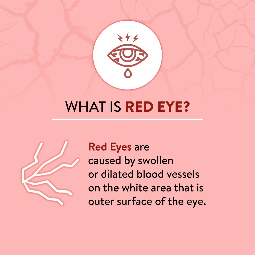 Lifezen EyeSpa Red Redness Reliever Eye Drops 10ML (Pack of 2) | Help in Discomfort from Burning, Itchiness & Redness of the eyes