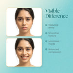 Moha Face Moisturizer for Oily Skin 100ml - Non-Comedogenic Matte Gel Cream