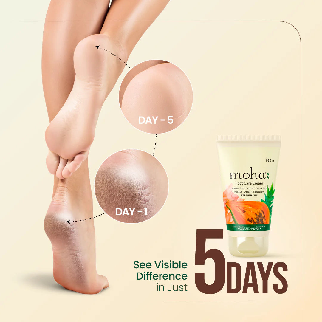 Moha: Foot Care Cream (100g)- Ayurvedic Cracked Heel Repair & Dry Skin Foot Cream