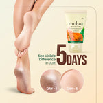 Moha: Foot Care Cream (100g)- Ayurvedic Cracked Heel Repair & Dry Skin Foot Cream