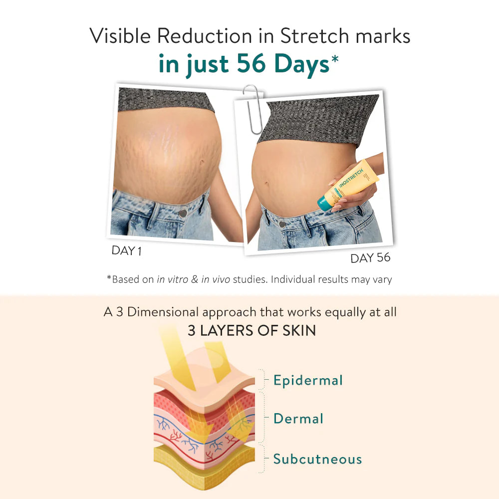 Lifezen Inostretch Stretch Mark Cream 60gm | Reduce Stretch Marks & Scars with Rutin, Shea Butter, Two Peptides, Coconut oil, Sunflower seed oil, Green Bean seed extract | Paraben Free & Dermatologist Approved Stretch Mark Removal Cream (Pack of 1)