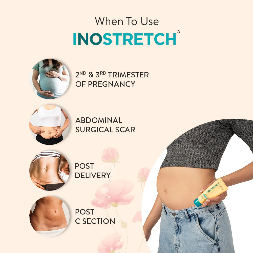 Lifezen Inostretch Stretch Mark Cream 60gm | Reduce Stretch Marks & Scars with Rutin, Shea Butter, Two Peptides, Coconut oil, Sunflower seed oil, Green Bean seed extract | Paraben Free & Dermatologist Approved Stretch Mark Removal Cream (Pack of 1)
