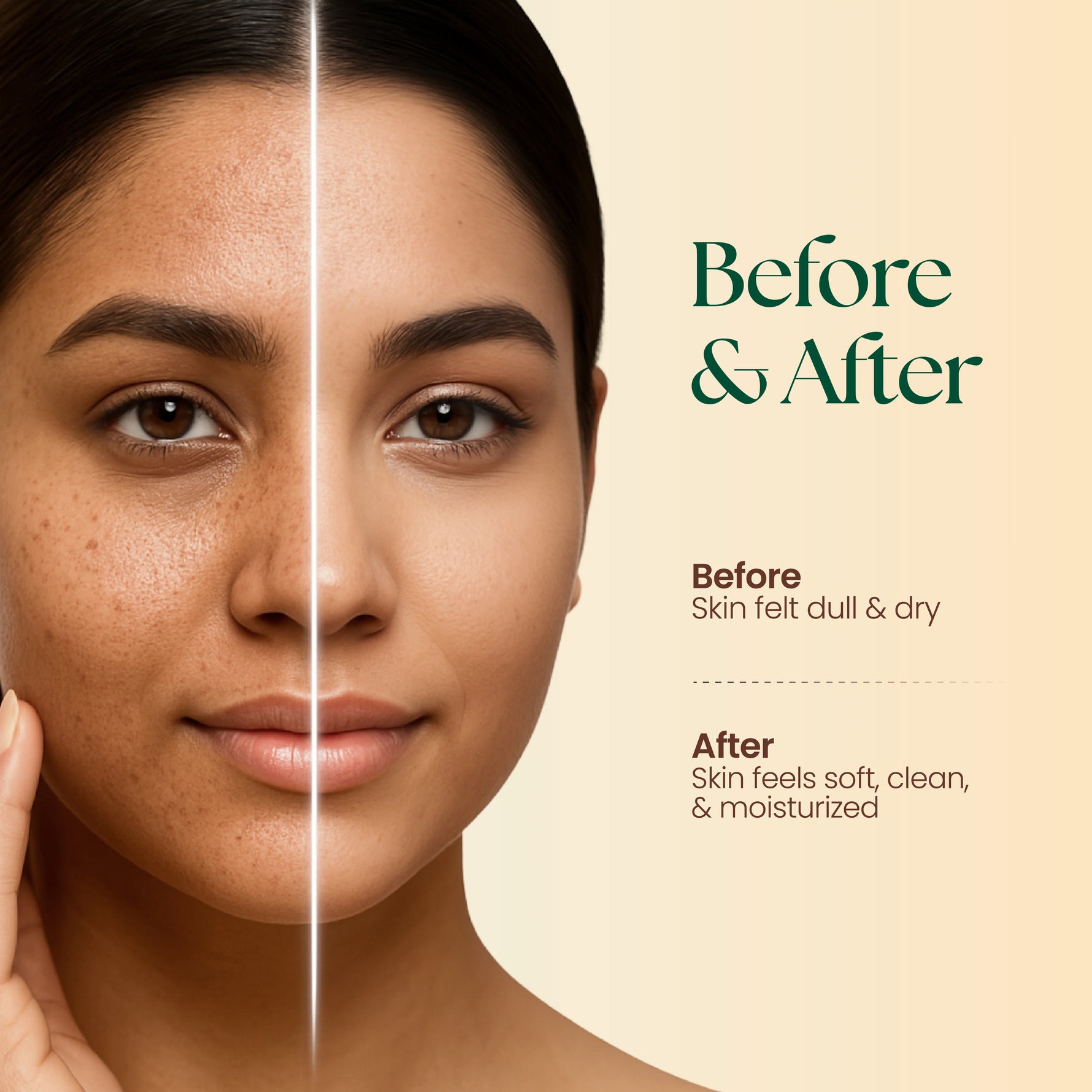 Moha: Herbal Face Wash (200ml) - Ayurvedic Anti-Acne & Pimple Clearing Cleanser