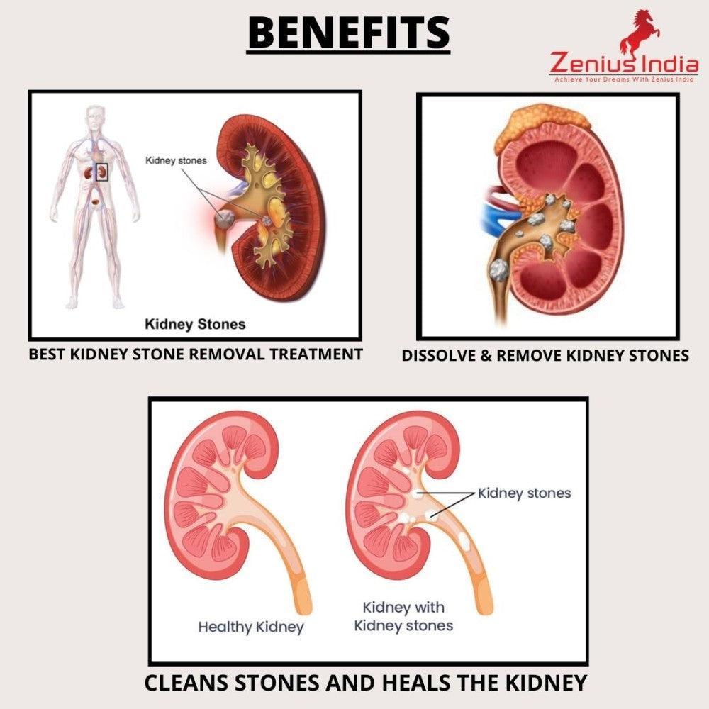 Zenius Stonil Capsule (60 Capsules)