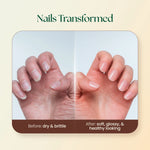 Moha: Nail Care Cream (100g)- Brittle Nail Strengthener & Cuticle Repair Cream