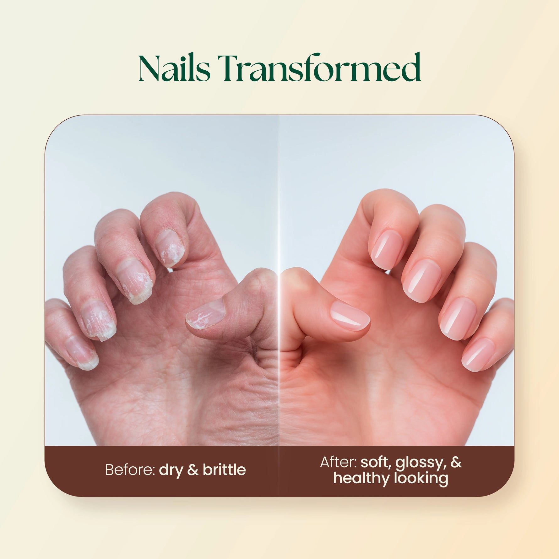Moha: Nail Care Cream (100g)- Brittle Nail Strengthener & Cuticle Repair Cream
