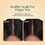 Moha: Anti-Dandruff Neem &amp; Hibiscus Shampoo - 200ml - High Azadirachtin Scalp Microbiome Balance