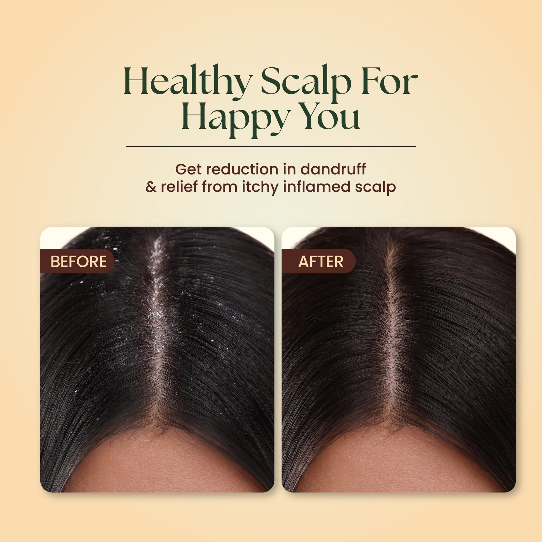 Moha: Anti-Dandruff Neem &amp; Hibiscus Shampoo - 200ml - High Azadirachtin Scalp Microbiome Balance