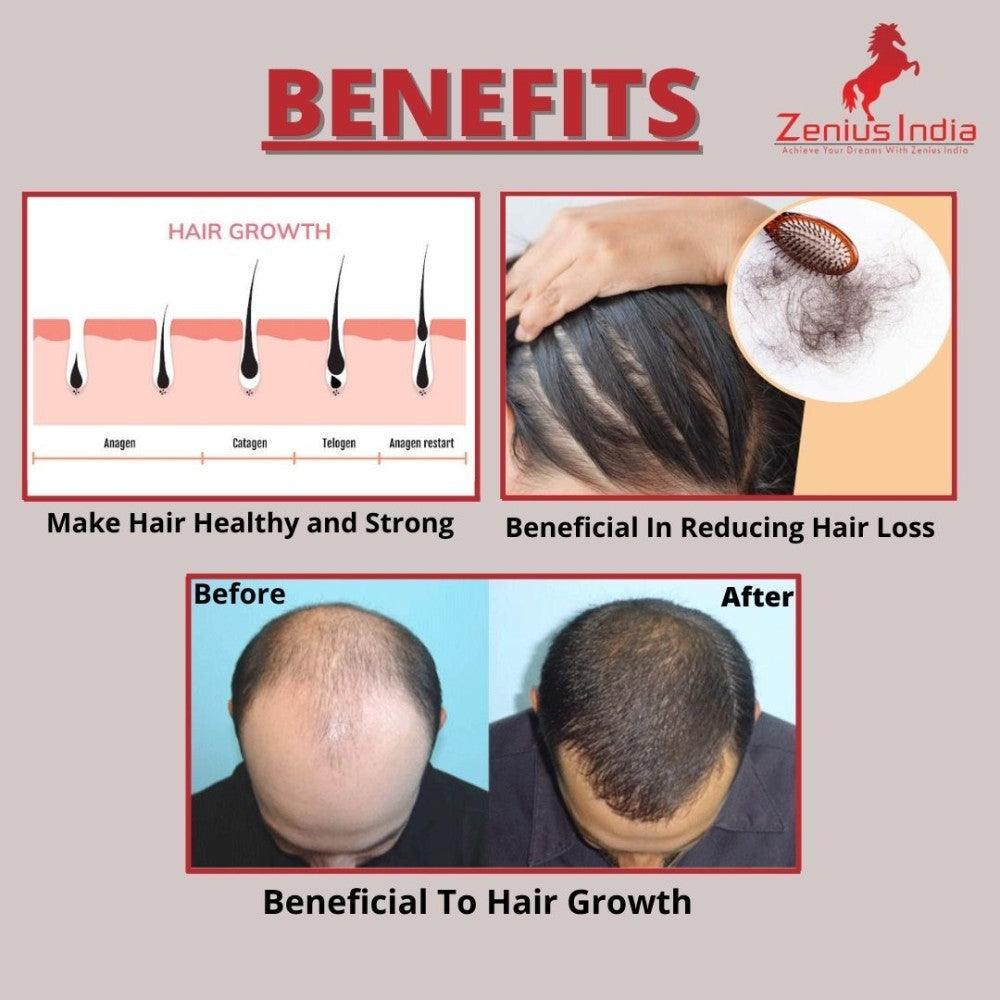 Zenius Hair Oil for hair growth, hair dandruff removal oil