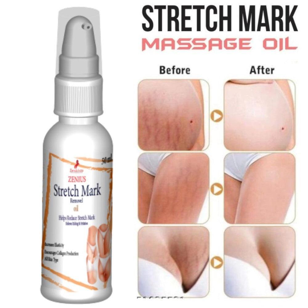 Zenius Stretch Mark Oil for All Skin Types
