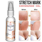 Zenius Stretch Mark Oil for All Skin Types