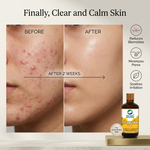 Organic Wellness Clear Skin Lotion - 100 ml