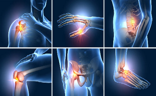Cipzer Habb-E-Asgand Pill - 50 Pills | Joint Pain Relief, Bone Strength, Arthritis & Muscle Support
