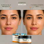 WellWith Sea Buckthorn Moisturizing Cream (50g)