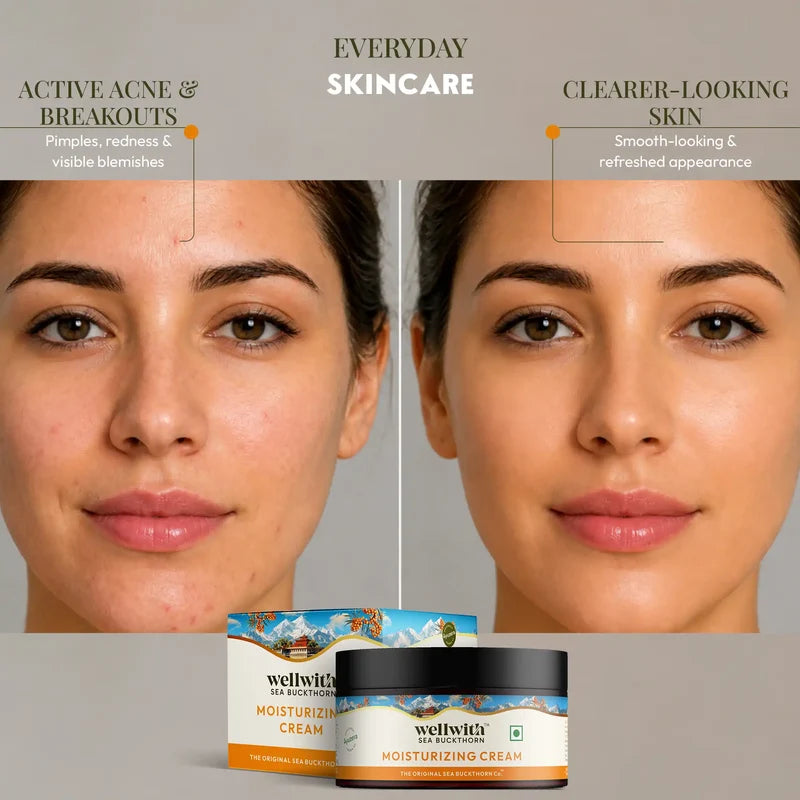 WellWith Sea Buckthorn Moisturizing Cream (50g)