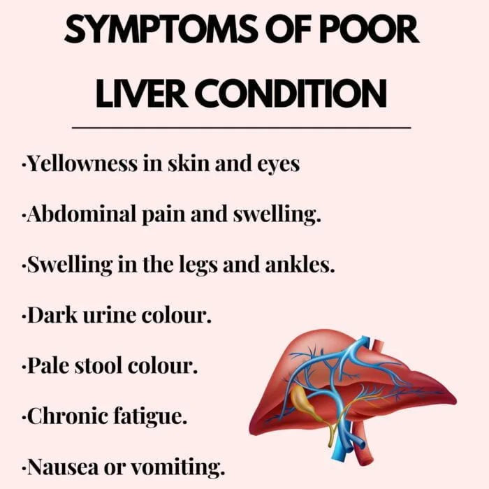 Healthally Biolive Syrup for Liver Support | Fatty Liver Detox Biolive Syrup 500 ml