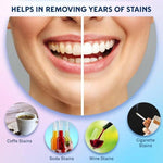 BonAiyu Teeth Whitening Strip
