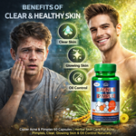 Cipzer Acne & Pimple Capsules for Clarifying Support - Herbal Blemish Control & Skin Purity (60 Capsules)