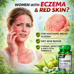 Cipzer Eczema Total Skin Capsules - Natural Skin Comfort & Irritation Support (60 Capsules)