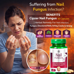 Cipzer Nail Wellness Capsules - Restorative Support for Nail Clarity & Strength (60 Capsules)
