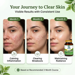 Organic Wellness Acne-Never Capsules - 90 Capsules