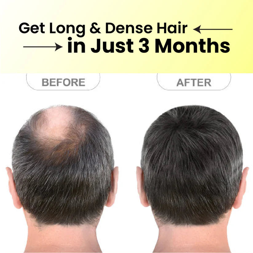 Cipzer Hair & Handsome Oil - 100ML | Herbal Hair Growth, Strength, Shine & Scalp Nourishment