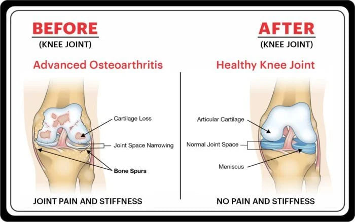 Bansiwala Pain Guard Oil for Joint Pain | Ayurvedic Pain Relief Oil