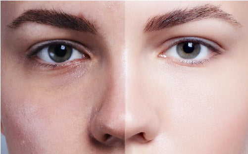 Cipzer Blood Purifier 60 Capsules | Herbal Detox for Clear Skin, Healthy Blood & Body Cleansing