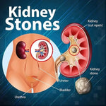 Healthally Uriactive Syrup – Kidney Detox & Stone Remove | Supports Renal Care, Flushes Toxins, Promotes Urinary Health